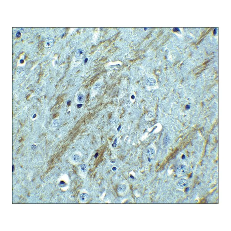 Merck Anti-BACE antibody produced in rabbit