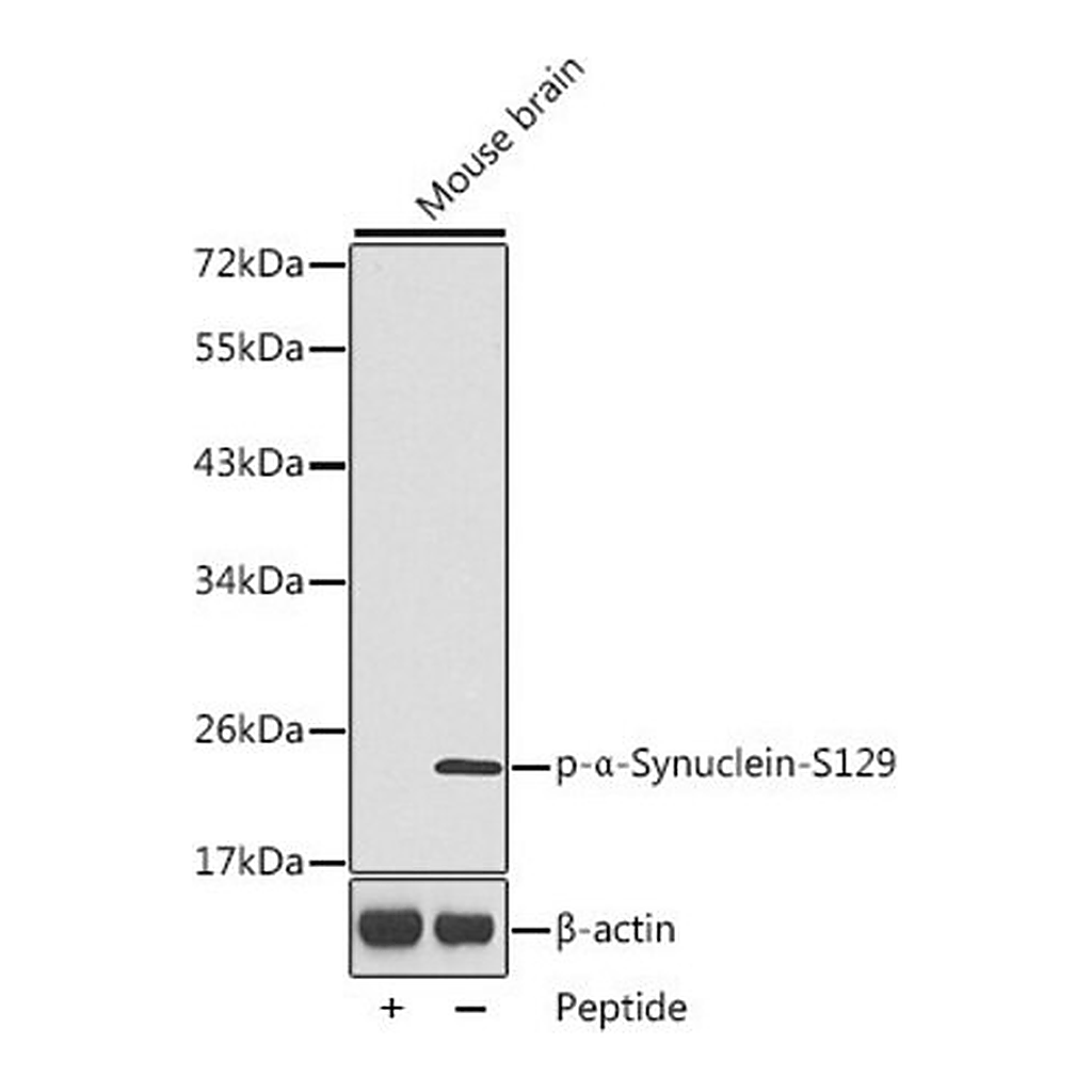 Merck Anti-Phospho-alpha-Synuclein-S129 antibody produced in rabbit