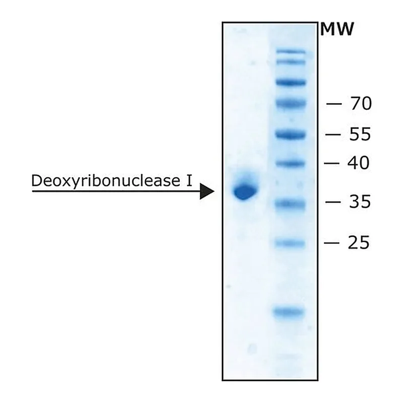 Merck Deoxyribonuclease I bovine