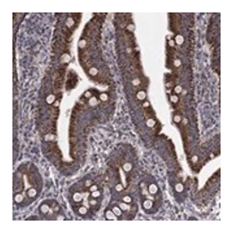 Merck Anti-PNPLA2 antibody produced in rabbit
