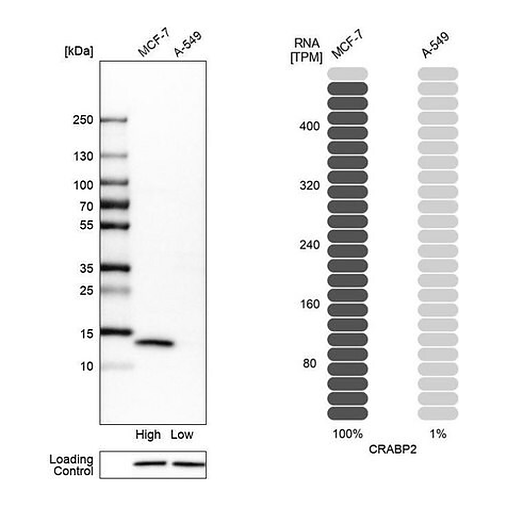 Merck Anti-CRABP2 antibody produced in rabbit