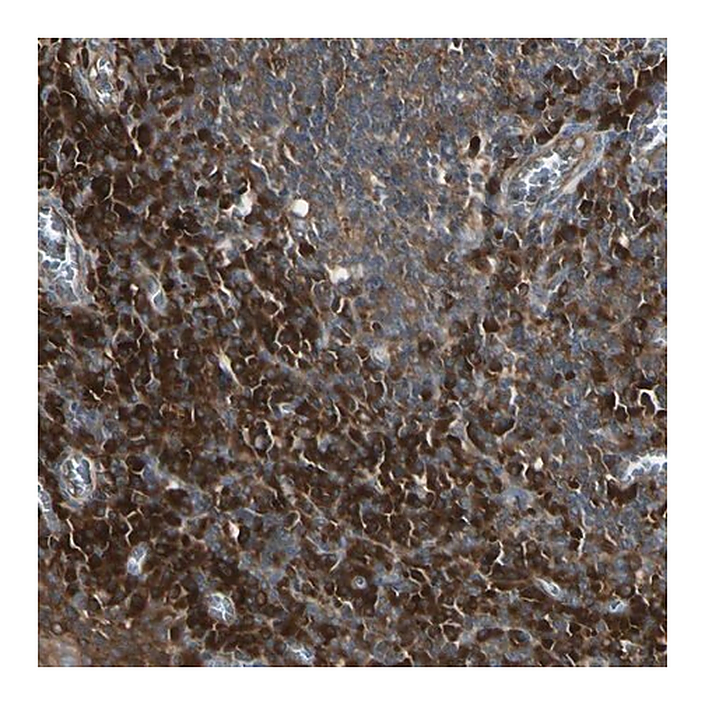 Merck Anti-NME1 antibody produced in rabbit