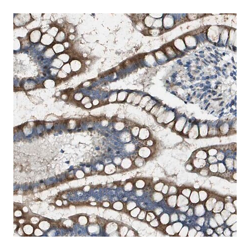 Merck Anti-MGAT3 antibody produced in rabbit