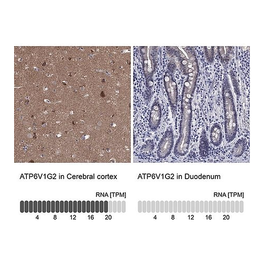 Merck Anti-ATP6V1G2 antibody produced in rabbit