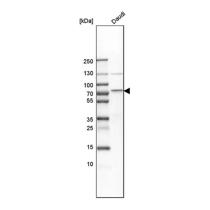 Atlas Antibodies Anti-BIRC3 Antibody