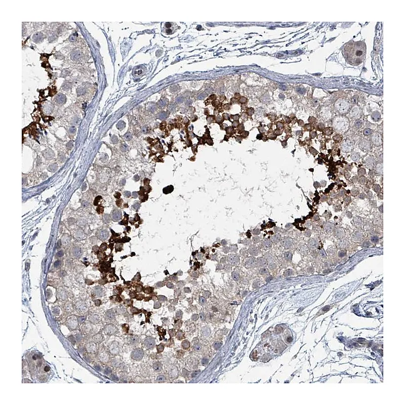 Atlas Antibodies Anti-BIVM Antibody