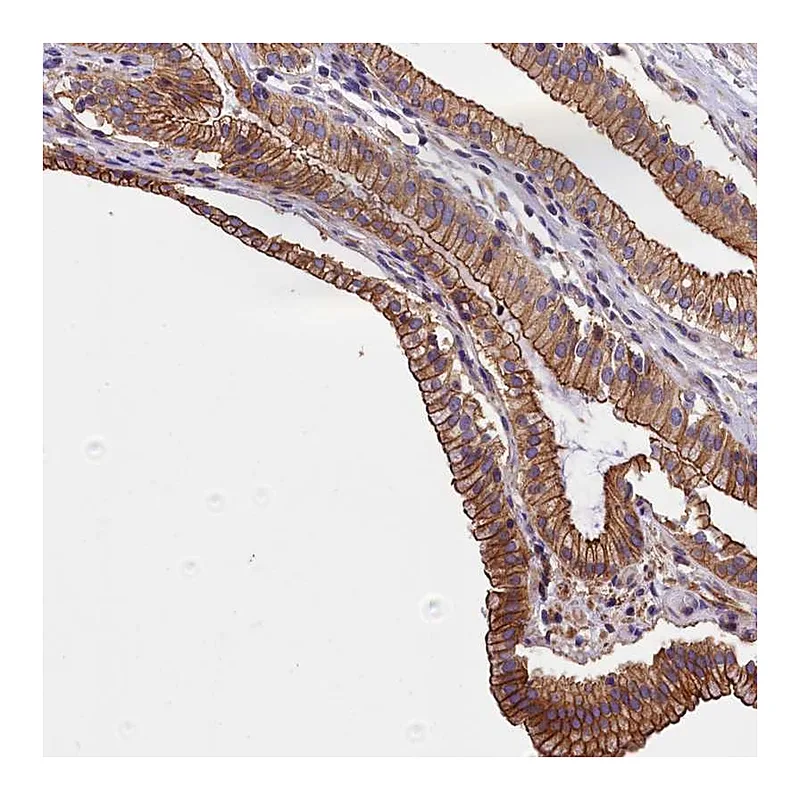 Atlas Antibodies Anti-BLACE Antibody