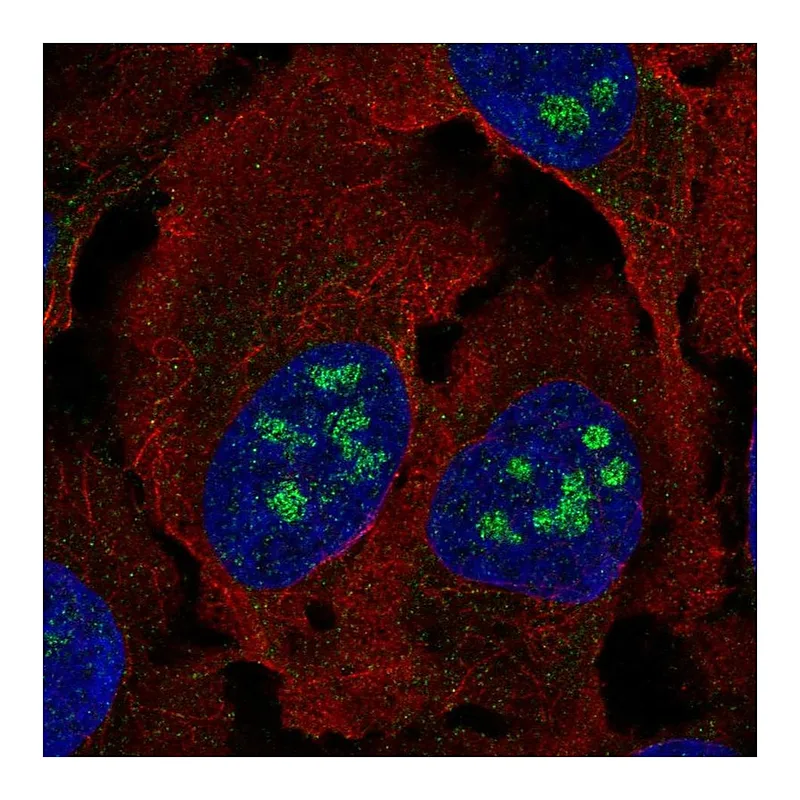 Atlas Antibodies Anti-BLCAP Antibody