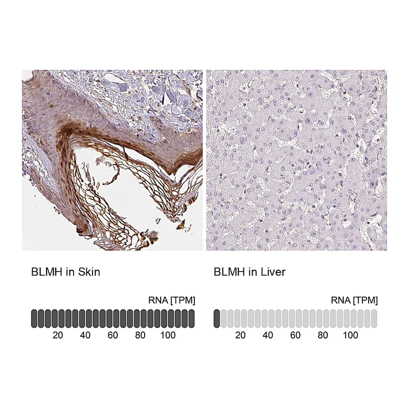 Atlas Antibodies Anti-BLMH Antibody