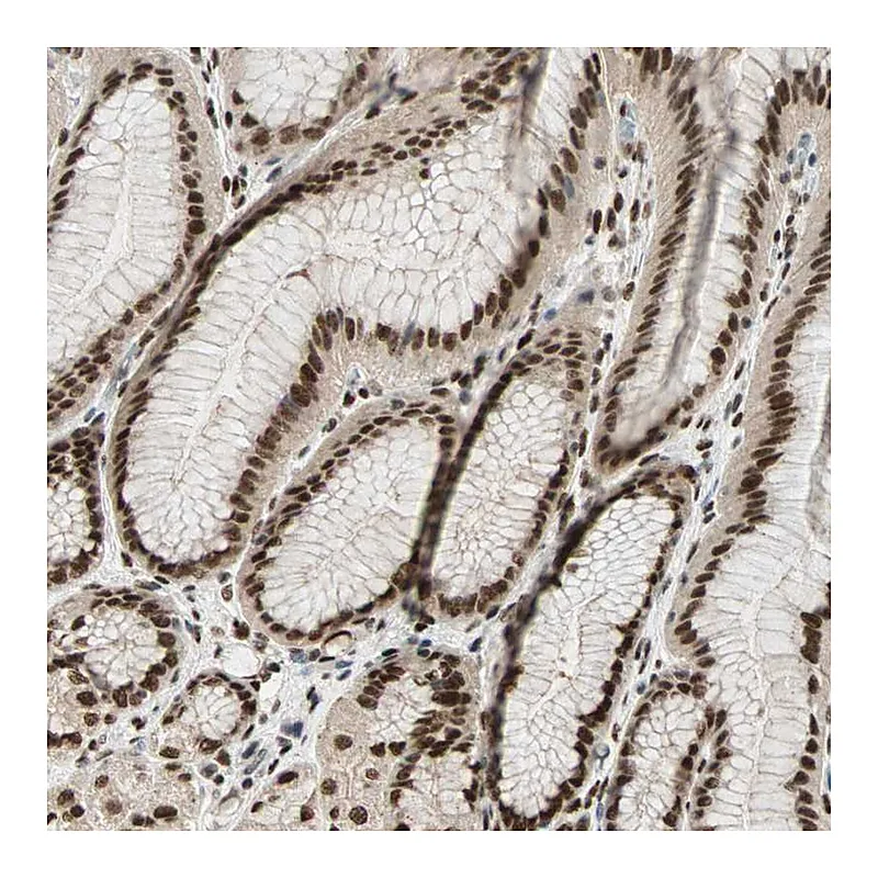 Atlas Antibodies Anti-BLM Antibody