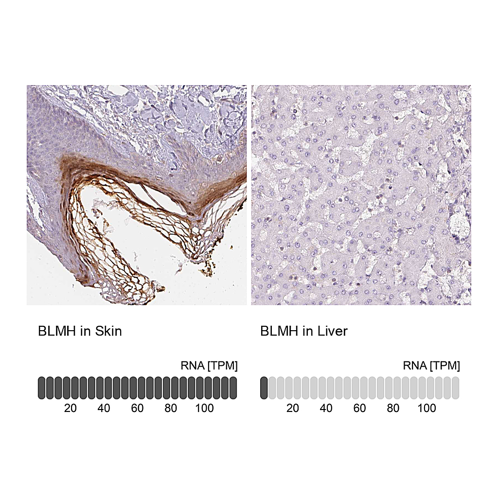 Atlas Antibodies Anti-BLMH Antibody