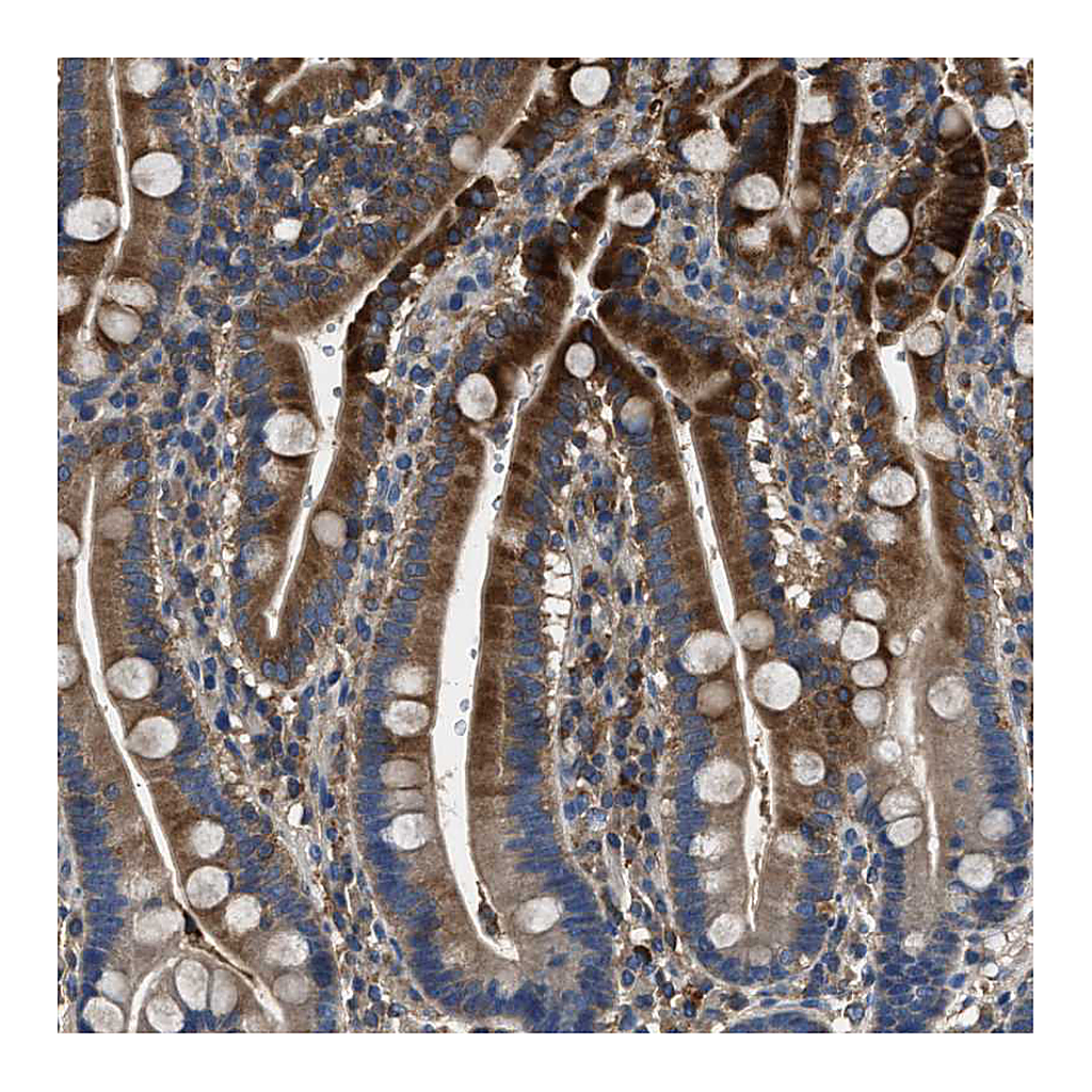 Atlas Antibodies Anti-BLOC1S1 Antibody
