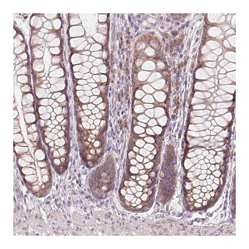 Atlas Antibodies Anti-BLOC1S2 Antibody