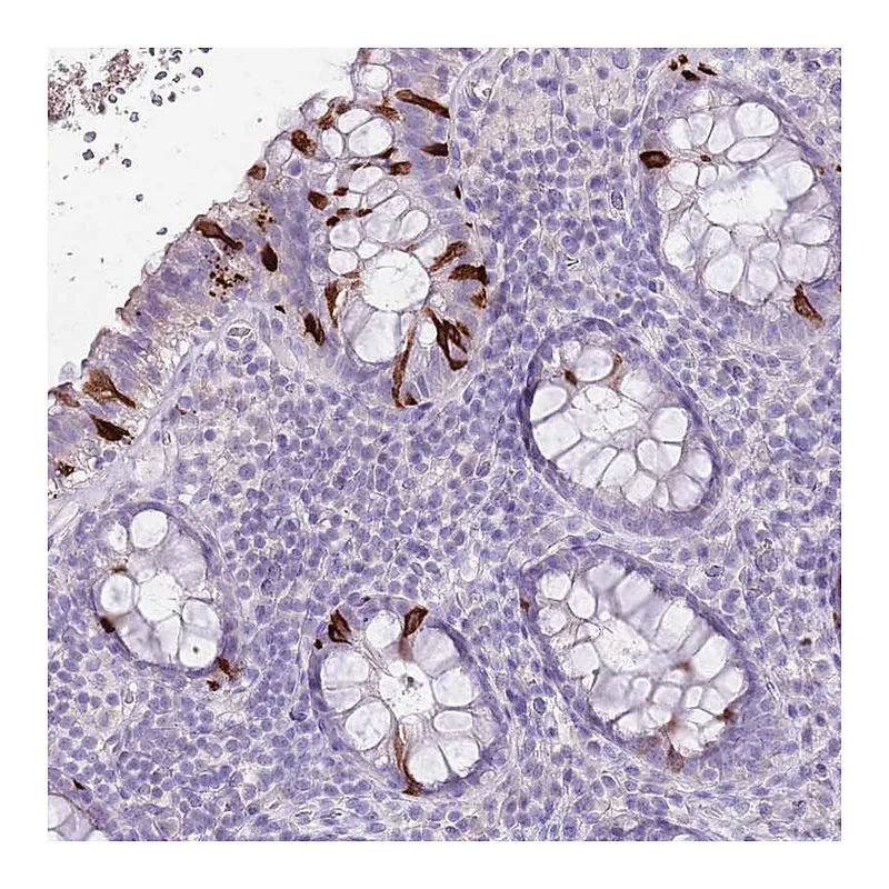 Atlas Antibodies Anti-BLOC1S2 Antibody