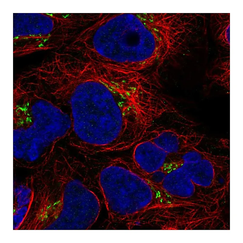 Atlas Antibodies Anti-BLOC1S3 Antibody