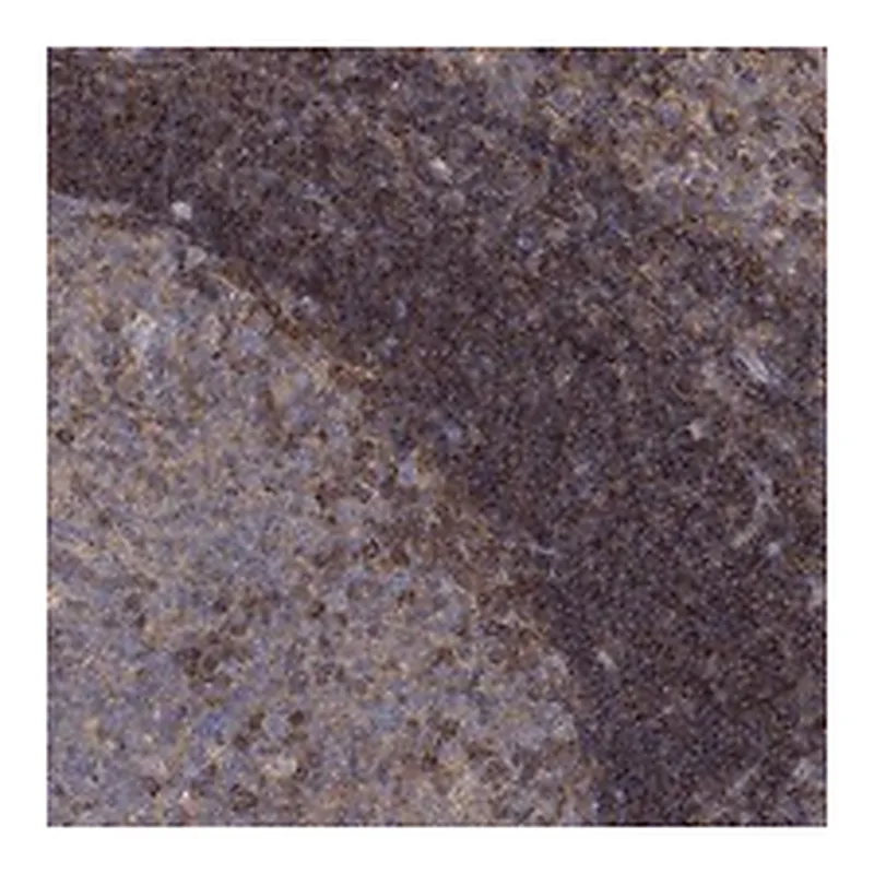Atlas Antibodies Anti-BLOC1S3 Antibody
