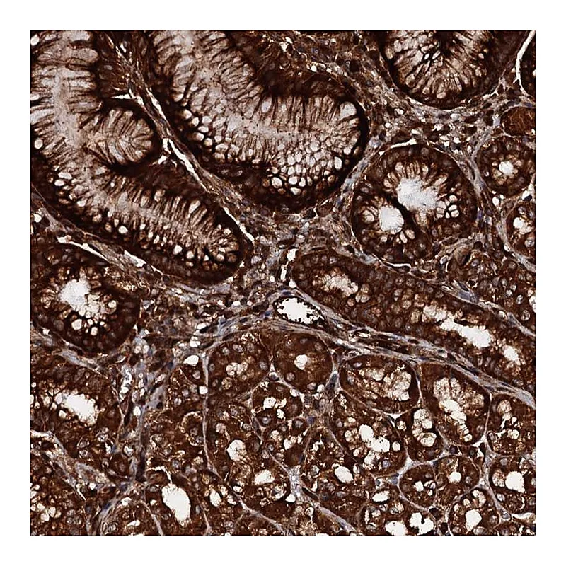 Atlas Antibodies Anti-BLOC1S6 Antibody
