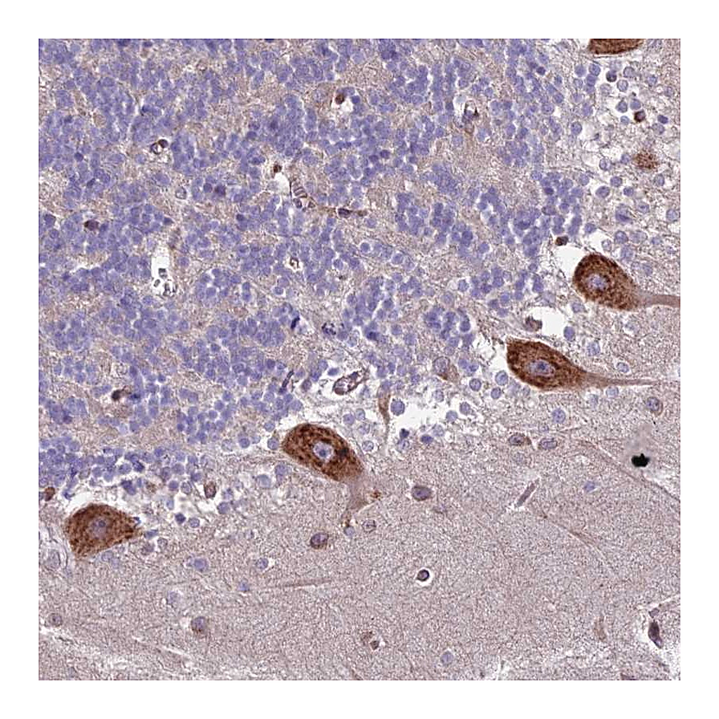 Atlas Antibodies Anti-BLOC1S4 Antibody