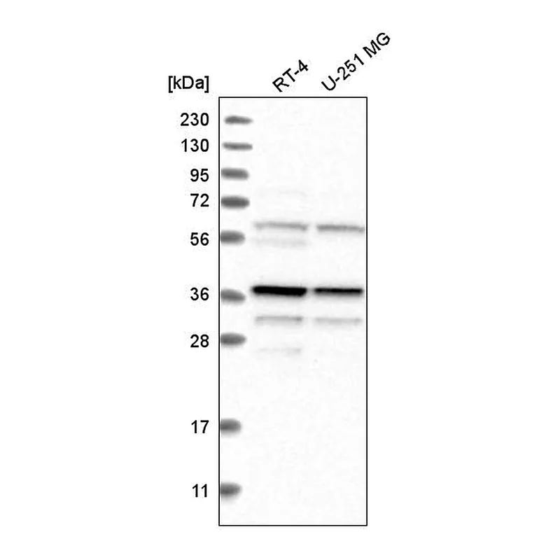 Atlas Antibodies Anti-BLVRA Antibody