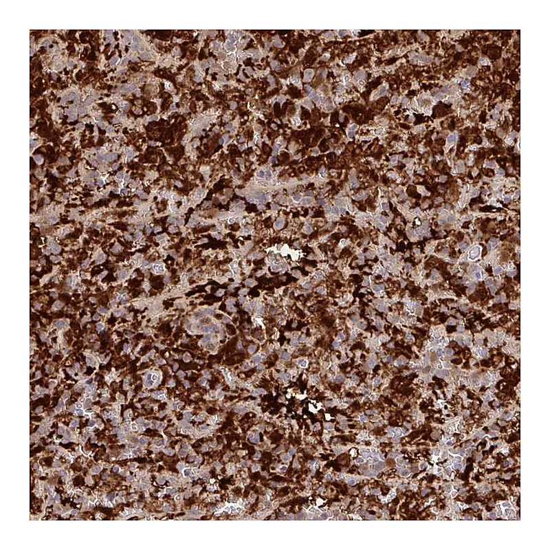 Atlas Antibodies Anti-BLVRA Antibody