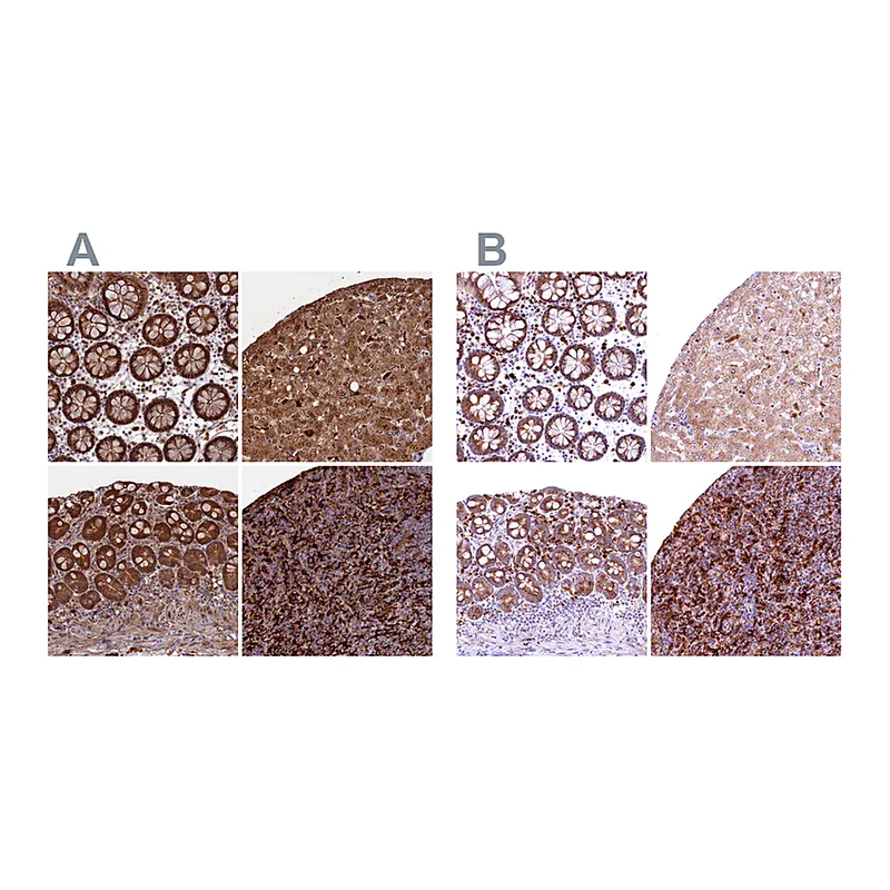Atlas Antibodies Anti-BLVRB Antibody