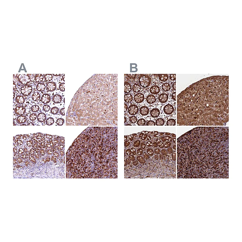 Atlas Antibodies Anti-BLVRB Antibody