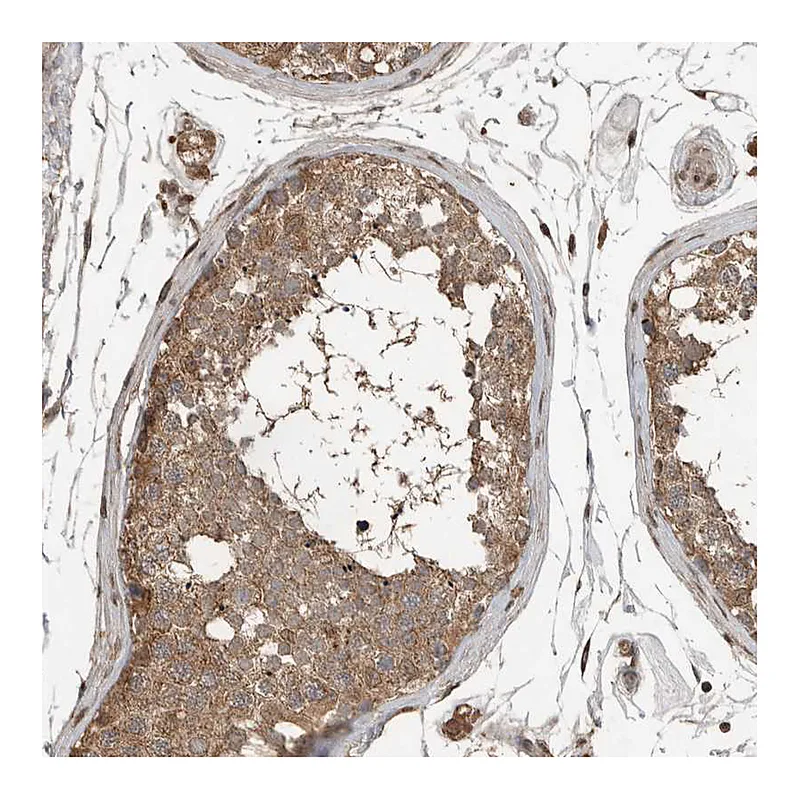 Atlas Antibodies Anti-BLZF1 Antibody