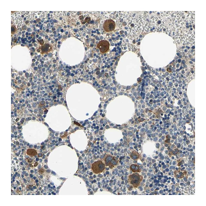 Atlas Antibodies Anti-BMF Antibody