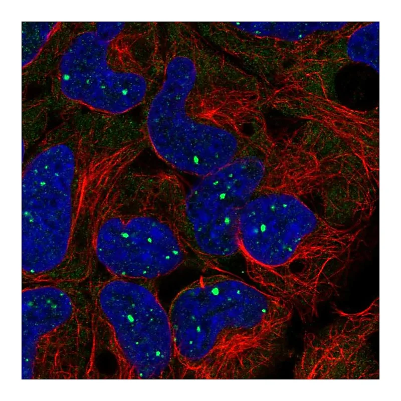 Atlas Antibodies Anti-BMI1 Antibody