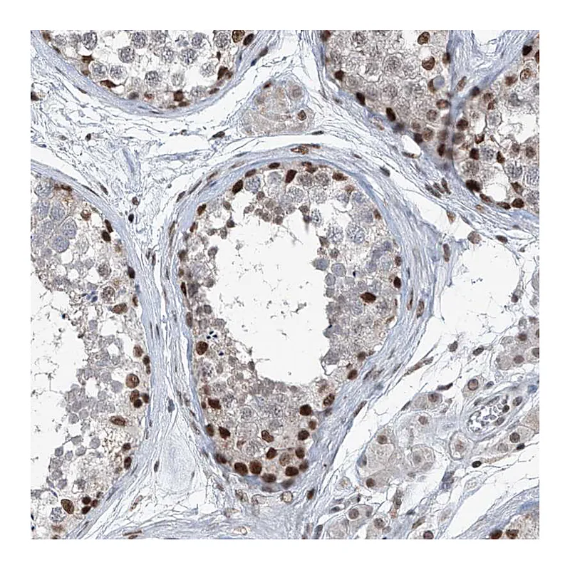 Atlas Antibodies Anti-BMI1 Antibody