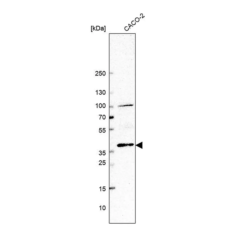 Atlas Antibodies Anti-BMP2 Antibody