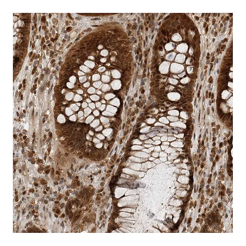 Atlas Antibodies Anti-BMP2K Antibody