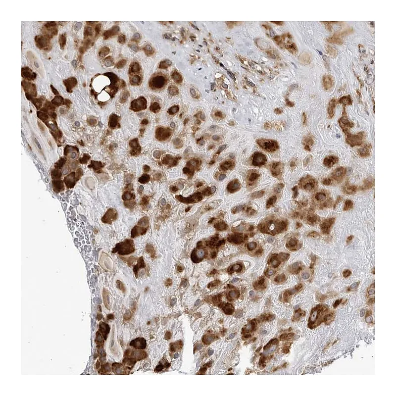 Atlas Antibodies Anti-BMP2K Antibody
