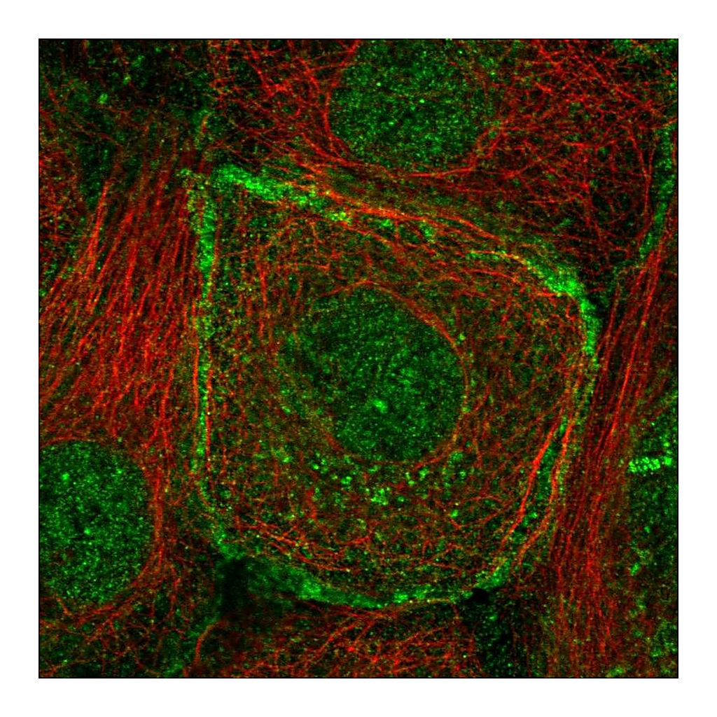 Atlas Antibodies Anti-BMPR2 Antibody