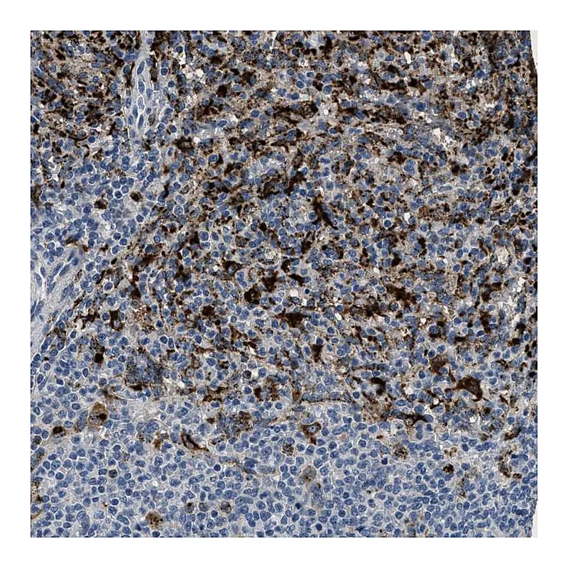 Atlas Antibodies Anti-BMPR2 Antibody
