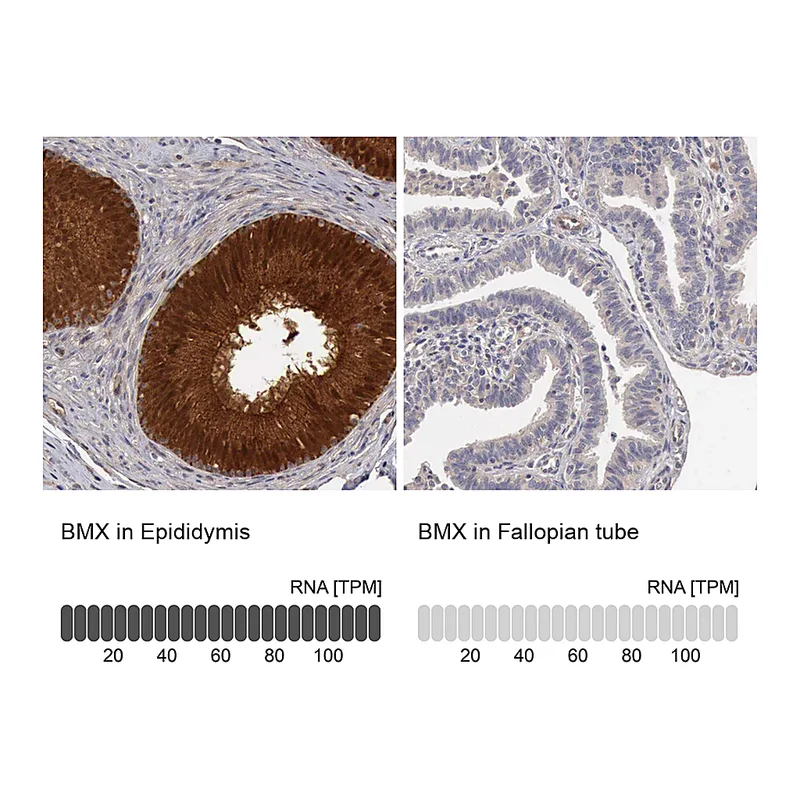 Atlas Antibodies Anti-BMX Antibody