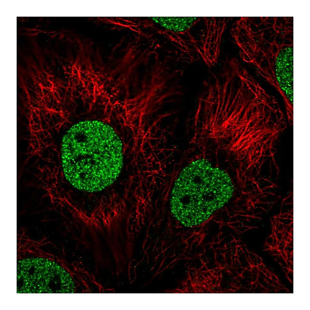 Atlas Antibodies Anti-BNC1 Antibody