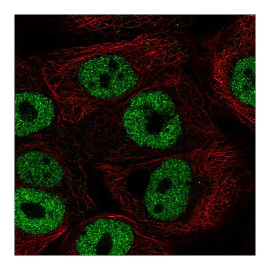 Atlas Antibodies Anti-BNC1 Antibody