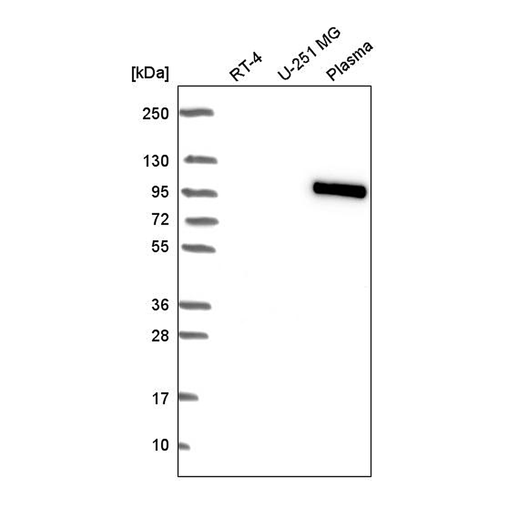 Atlas Antibodies Anti-BNC1 Antibody