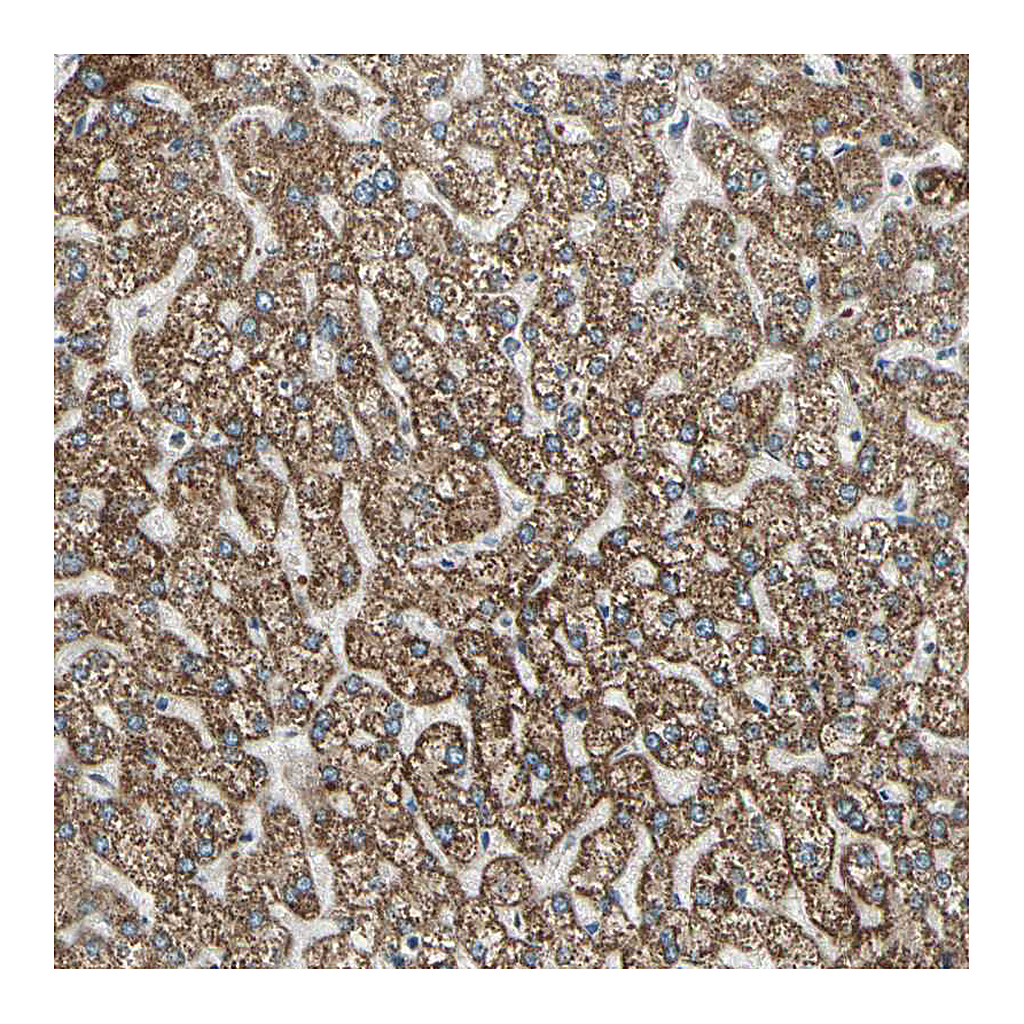 Atlas Antibodies Anti-BNIP1 Antibody