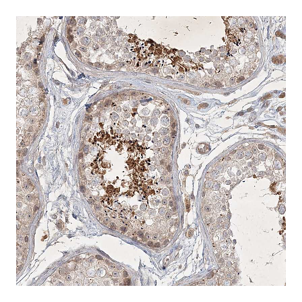 Atlas Antibodies Anti-BOD1 Antibody