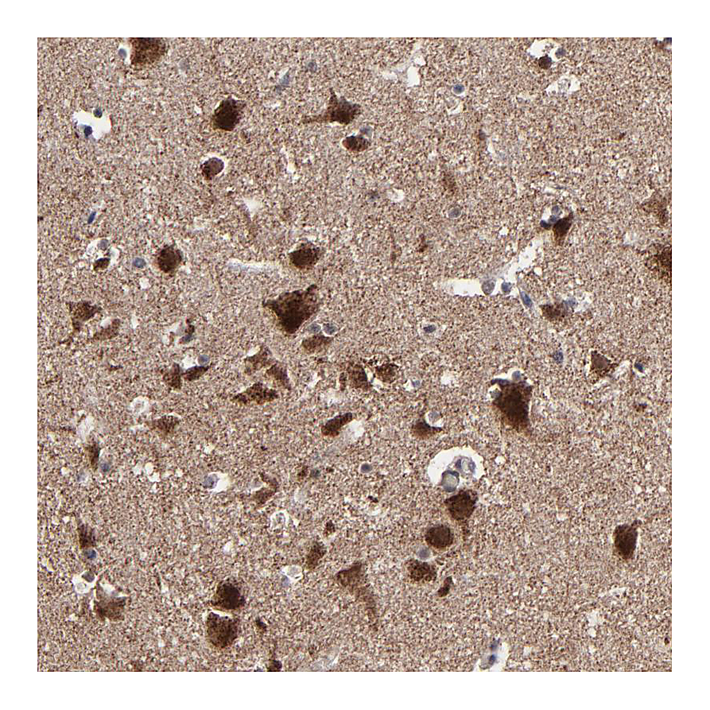 Atlas Antibodies Anti-BNIP3 Antibody