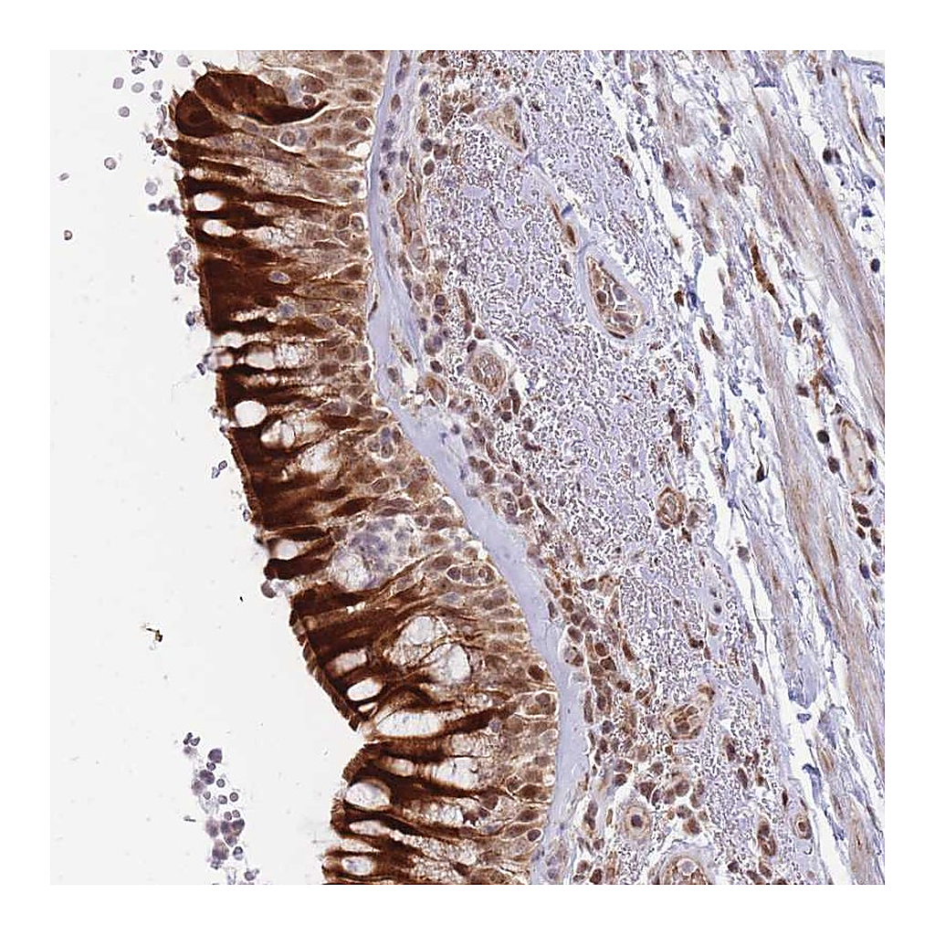 Atlas Antibodies Anti-BOD1L1 Antibody