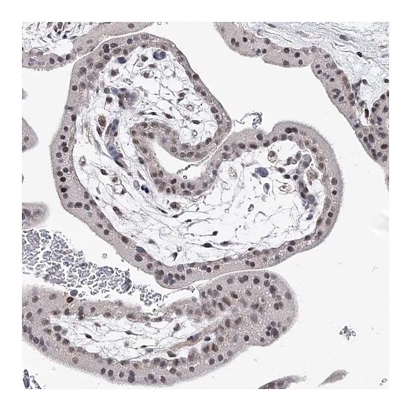 Atlas Antibodies Anti-BOD1L1 Antibody