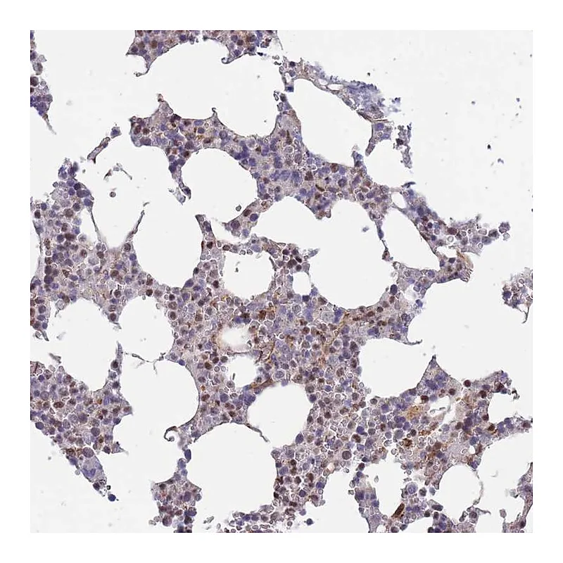 Atlas Antibodies Anti-BOD1L1 Antibody