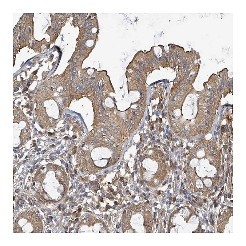 Atlas Antibodies Anti-BOLA2 Antibody
