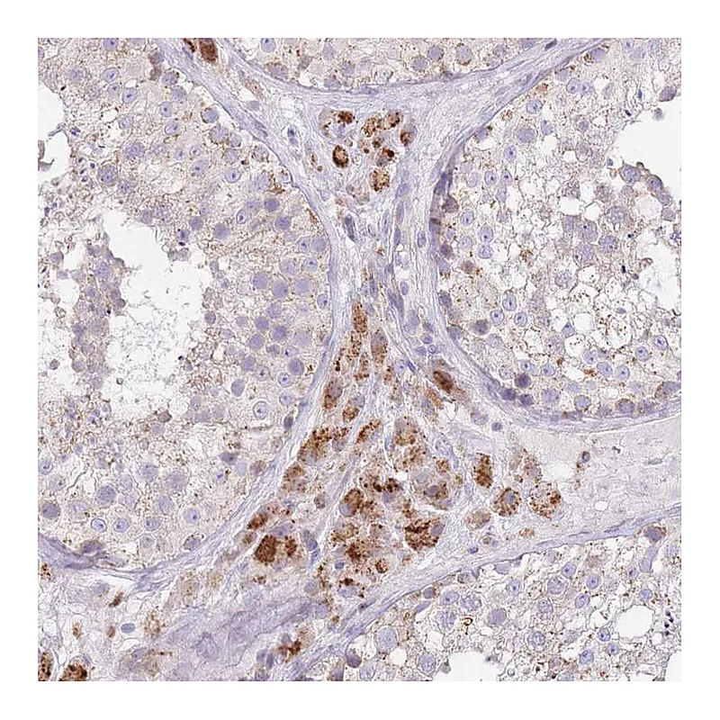 Atlas Antibodies Anti-BOLA2 Antibody