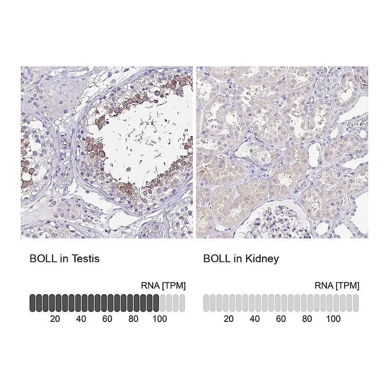 Atlas Antibodies Anti-BOLL Antibody