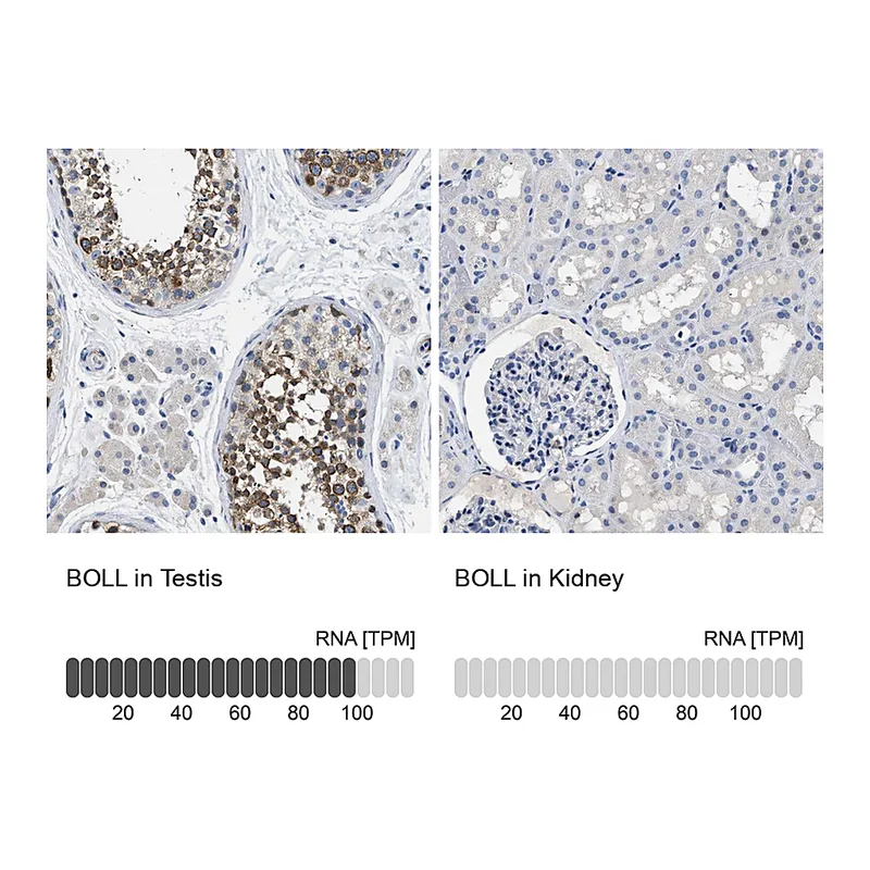 Atlas Antibodies Anti-BOLL Antibody