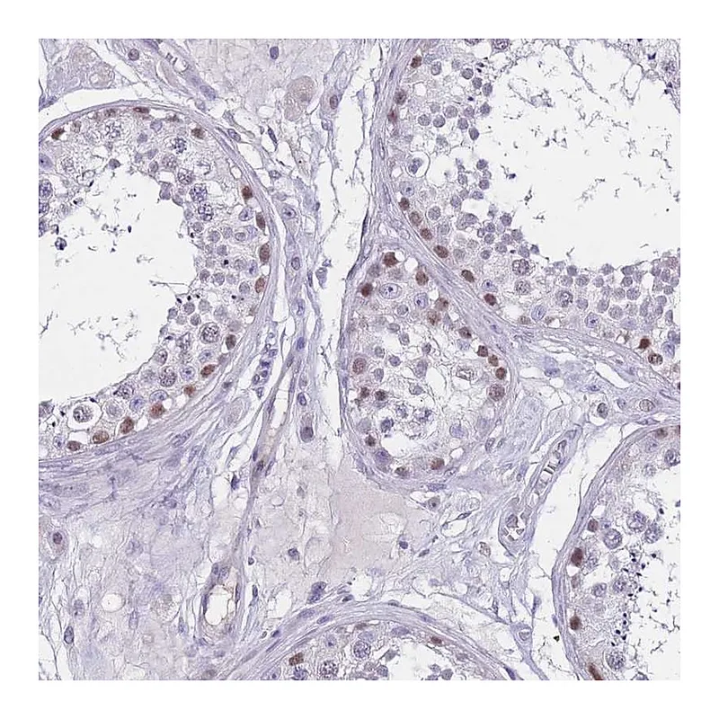 Atlas Antibodies Anti-BOP1 Antibody